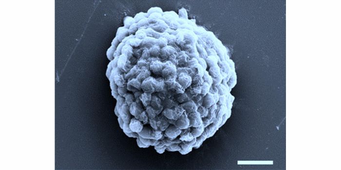 Электронно-микроскопическое изображение плотно упакованных клеток водорослей, продуцирующих водород. Масштабная линейка - 10 мкм. Предоставлено: Prof Xin Huang, Harbin Institute of Technology